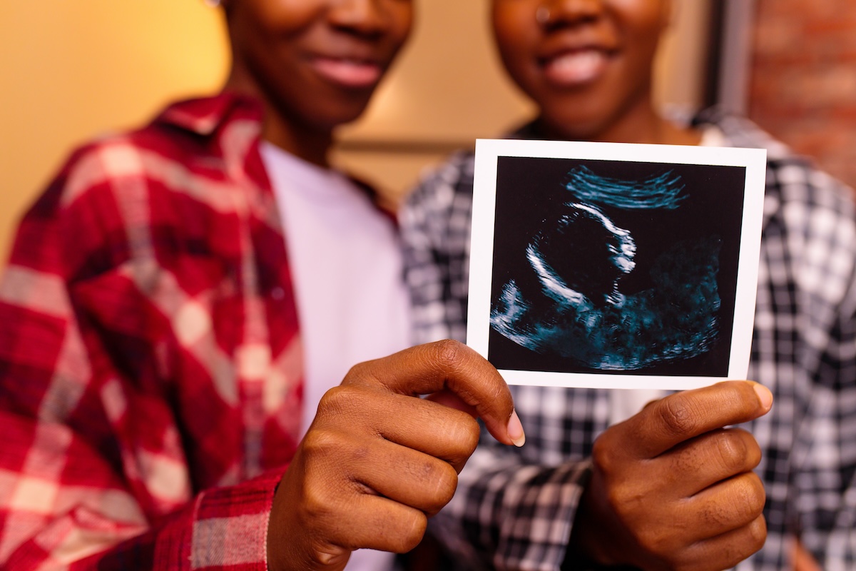Two people smiling joyfully, holding an ultrasound image showcasing a fetus. The focus is on the ultrasound held in their hands.