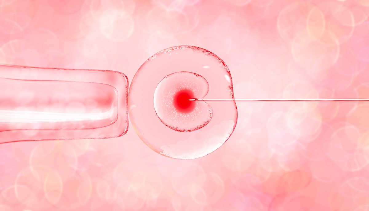 Representation of the in vitro fertilization (IVF) process, where a sperm is shown being injected into an egg.