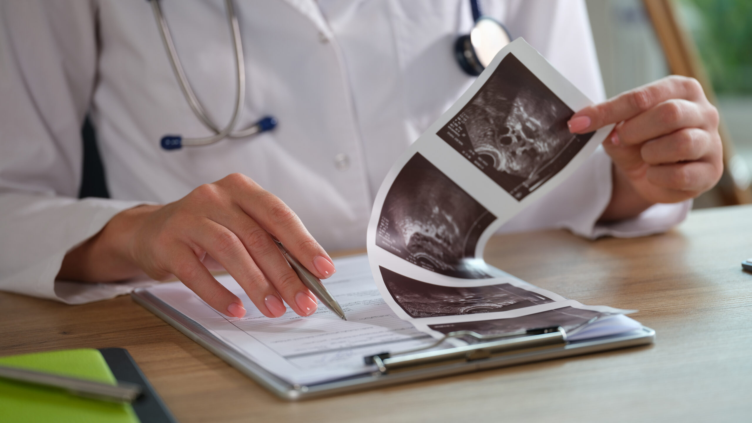 A doctor holding and reviewing a black-and-white ultrasound scan, with a clipboard and medical notes on the desk in the foreground.