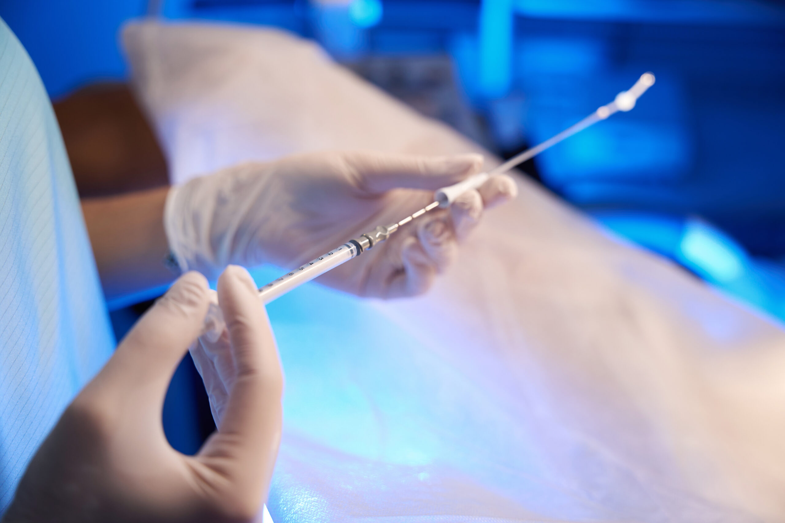 A medical professional holding an embryo transfer catheter in a clinic.